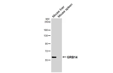 Anti-GRB14 antibody [HL3786] used in Western Blot (WB). GTX642005