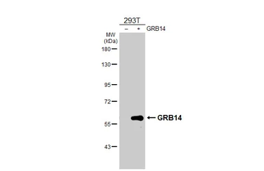 Anti-GRB14 antibody [HL3786] used in Western Blot (WB). GTX642005