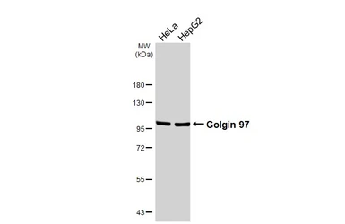 Anti-Golgin 97 antibody [HL3788] used in Western Blot (WB). GTX642007