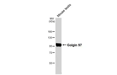 Anti-Golgin 97 antibody [HL3788] used in Western Blot (WB). GTX642007