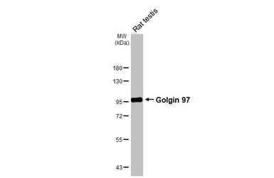 Anti-Golgin 97 antibody [HL3788] used in Western Blot (WB). GTX642007