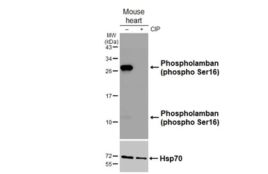 Anti-Phospholamban (phospho Ser16) antibody [HL3794] used in Western Blot (WB). GTX642013