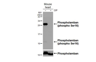 Anti-Phospholamban (phospho Ser16) antibody [HL3794] used in Western Blot (WB). GTX642013