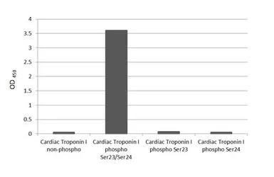 Anti-Cardiac Troponin I (phospho Ser23/Ser24) antibody [HL3798] used in  (). GTX642017