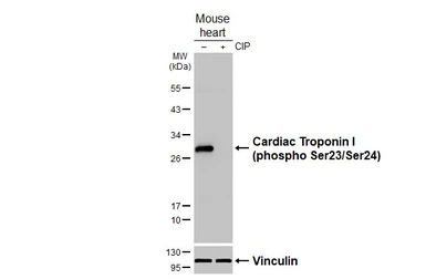 Anti-Cardiac Troponin I (phospho Ser23/Ser24) antibody [HL3798] used in Western Blot (WB). GTX642017