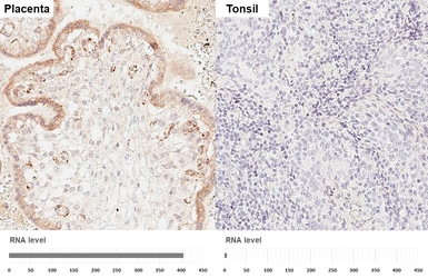 Anti-VEGF Receptor 1 antibody [HL3799] used in IHC (Paraffin sections) (IHC-P). GTX642018