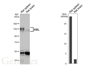 Anti-AXL antibody [HL3804] used in Western Blot (WB). GTX642023