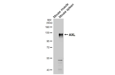 Anti-AXL antibody [HL3804] used in Western Blot (WB). GTX642023