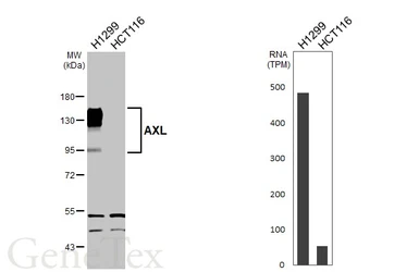 Anti-AXL antibody [HL3804] used in Western Blot (WB). GTX642023