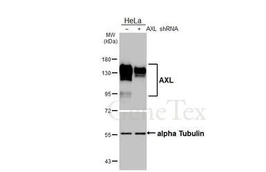 Anti-AXL antibody [HL3804] used in Western Blot (WB). GTX642023