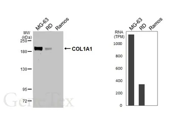 Anti-COL1A1 antibody [GT91] used in Western Blot (WB). GTX642024