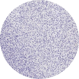 Anti-EGFRvIII antibody [H3805] HistoMAX&trade; used in IHC (Paraffin sections) (IHC-P). GTX642029