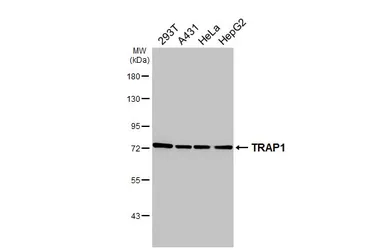 Anti-TRAP1 antibody [HL3809] used in Western Blot (WB). GTX642033