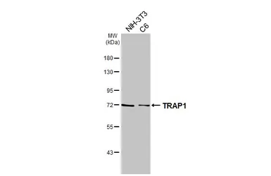 Anti-TRAP1 antibody [HL3809] used in Western Blot (WB). GTX642033
