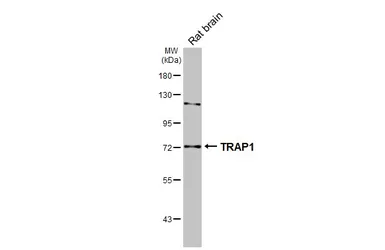 Anti-TRAP1 antibody [HL3809] used in Western Blot (WB). GTX642033