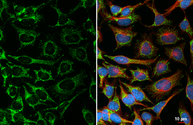 Anti-TRAP1 antibody [HL3809] used in Immunocytochemistry/ Immunofluorescence (ICC/IF). GTX642033