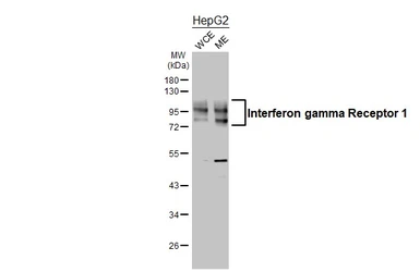 Anti-Interferon gamma Receptor 1 antibody [HL3811] used in Western Blot (WB). GTX642035