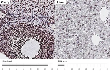Anti-ALY antibody [HL3813] used in IHC (Paraffin sections) (IHC-P). GTX642037