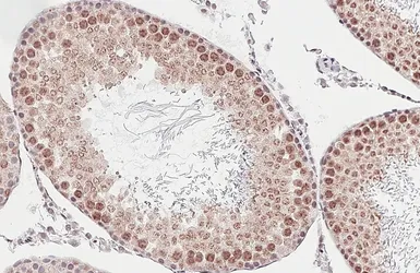 Anti-ALY antibody [HL3813] used in IHC (Paraffin sections) (IHC-P). GTX642037