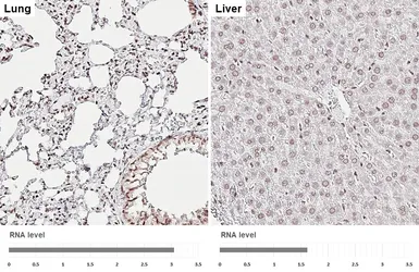 Anti-ALY antibody [HL3813] used in IHC (Paraffin sections) (IHC-P). GTX642037