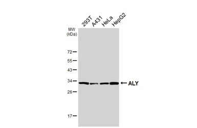 Anti-ALY antibody [HL3813] used in Western Blot (WB). GTX642037