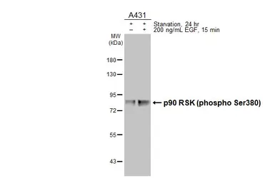 Anti-p90 RSK (phospho Ser380) antibody [HL3817] used in Western Blot (WB). GTX642041