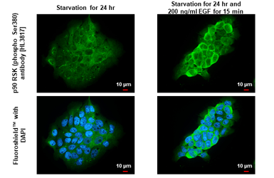 Anti-p90 RSK (phospho Ser380) antibody [HL3817] used in Immunocytochemistry/ Immunofluorescence (ICC/IF). GTX642041