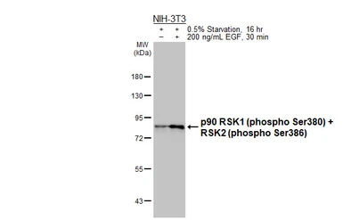 Anti-p90 RSK1 (phospho Ser380) + RSK2 (phospho Ser386) antibody [HL3818] used in Western Blot (WB). GTX642042