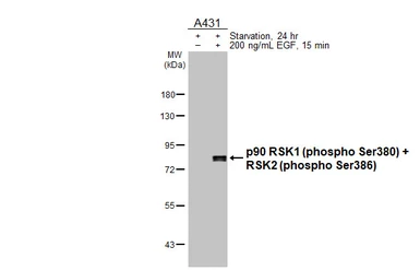 Anti-p90 RSK1 (phospho Ser380) + RSK2 (phospho Ser386) antibody [HL3818] used in Western Blot (WB). GTX642042