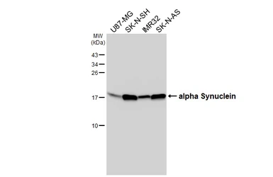 Anti-alpha Synuclein antibody [HL3835] used in Western Blot (WB). GTX642059