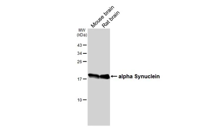 Anti-alpha Synuclein antibody [HL3835] used in Western Blot (WB). GTX642059