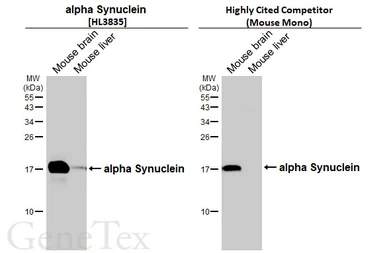Anti-alpha Synuclein antibody [HL3835] used in Western Blot (WB). GTX642059