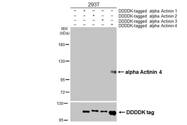 Anti-alpha Actinin 4 antibody [GT96] used in Western Blot (WB). GTX642061