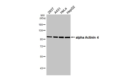 Anti-alpha Actinin 4 antibody [GT96] used in Western Blot (WB). GTX642061