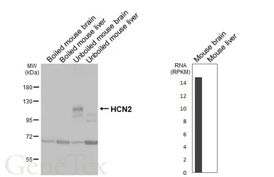Anti-HCN2 antibody [GT98] used in Western Blot (WB). GTX642063
