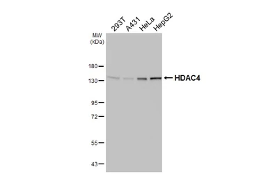 Anti-HDAC4 antibody [HL3838] used in Western Blot (WB). GTX642072