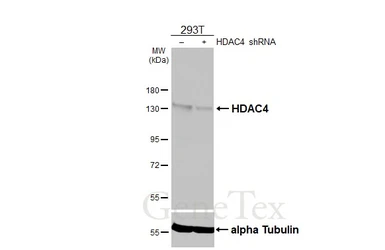 Anti-HDAC4 antibody [HL3838] used in Western Blot (WB). GTX642072