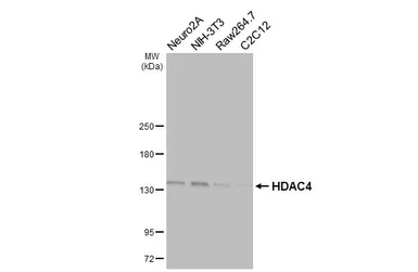 Anti-HDAC4 antibody [HL3838] used in Western Blot (WB). GTX642072