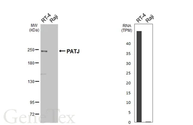 Anti-PATJ antibody [HL3842] used in Western Blot (WB). GTX642076