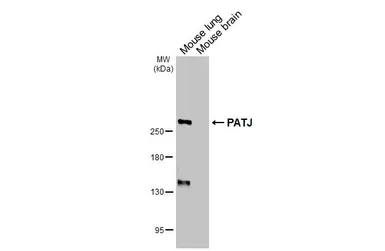 Anti-PATJ antibody [HL3842] used in Western Blot (WB). GTX642076