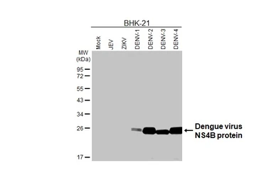 Anti-Dengue virus NS4B protein antibody [HL3844] used in Western Blot (WB). GTX642078