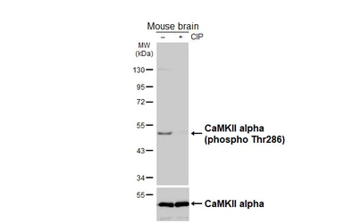 Anti-CaMKII (phospho Thr286) antibody [HL3848] used in Western Blot (WB). GTX642082