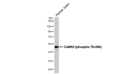 Anti-CaMKII (phospho Thr286) antibody [HL3848] used in Western Blot (WB). GTX642082
