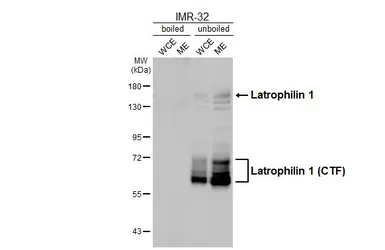 Anti-Latrophilin 1 antibody [HL3853] used in Western Blot (WB). GTX642087