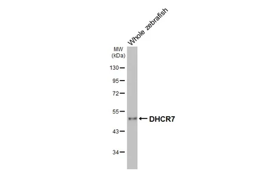 Anti-DHCR7 antibody [HL3854] used in Western Blot (WB). GTX642088