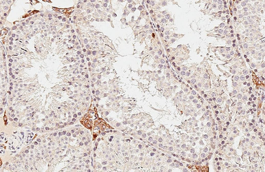 Anti-DHCR7 antibody [HL3854] used in IHC (Paraffin sections) (IHC-P). GTX642088