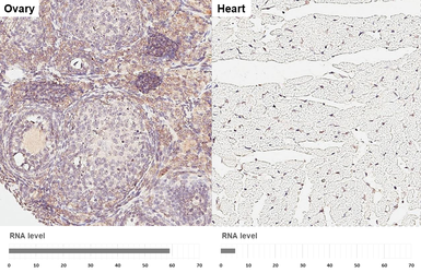 Anti-DHCR7 antibody [HL3854] used in IHC (Paraffin sections) (IHC-P). GTX642088