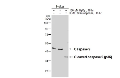 Anti-Caspase 9 antibody [HL3857] used in Western Blot (WB). GTX642095