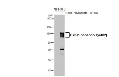 Anti-PYK2 (phospho Tyr402) antibody [HL3860] used in Western Blot (WB). GTX642098