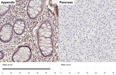 Anti-CXCL10 / IP10 antibody [HL3871] used in IHC (Paraffin sections) (IHC-P). GTX642109